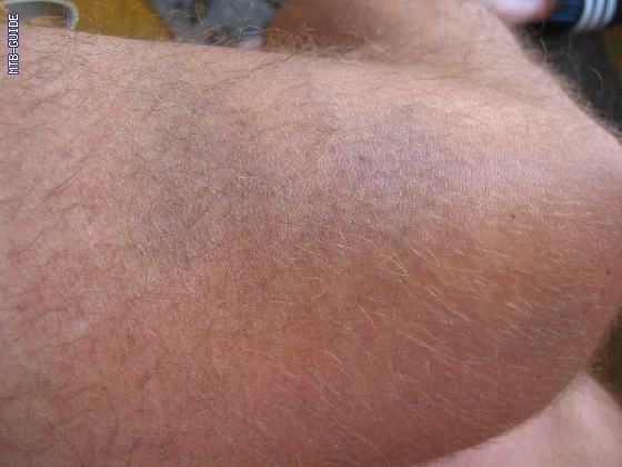 http://www.mtb-guide.de/pixlie/cache/vs_03_TAC_1195_Andalo.JPG